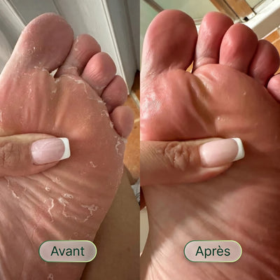 Savon Purifiant Antifongique