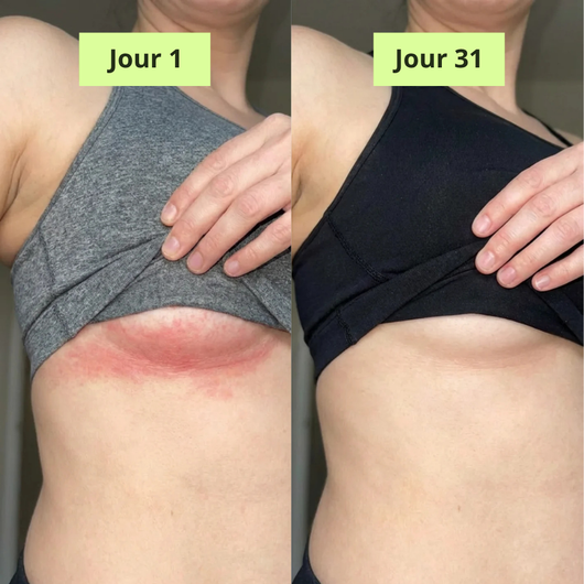 Nola Ritueel Zuiverende Antischimmel Zeep